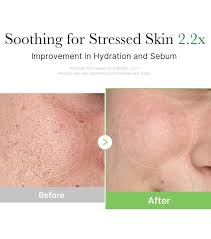 Medicube Exosome Cica Cream